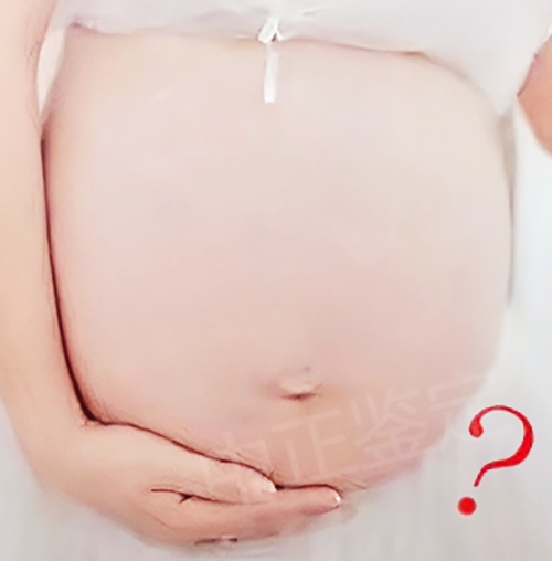 孕期亲子鉴定挂什么科